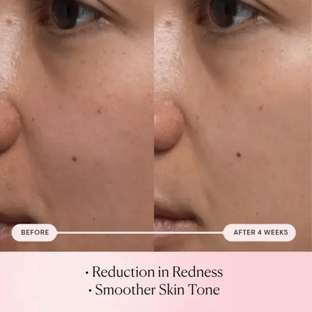 🌸 ELEMIS PRO-COLLAGEN ROSE MICRO SERUM - Picture 5 of 13